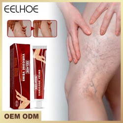 Мазь Eelhoe от варикозного расширения вен и боли в ногах